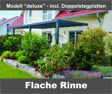 Modell "Deluxe" 3.000x3.000